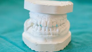 Plaster Dental model